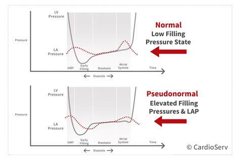 lv filling pressure|increased lv filling pressure.